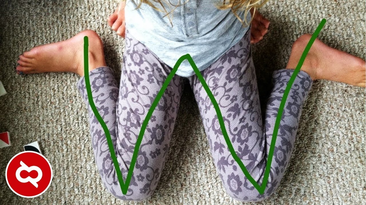 Posisi Duduk W Ternyata Berdampak Pada Bentuk Kaki Anak Anda