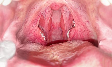 Batu Amandel, Kelenjar Pada Bagian Belakang Tenggorokan