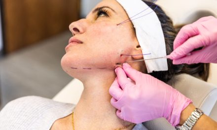 Thread Lift Jadi Trend Dalam Dunia Kecantikan Terkini