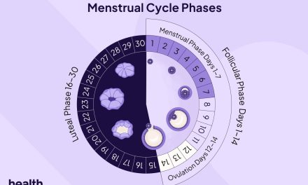Siklus Menstruasi Yang Terganggu Harus Di Tangani Segera